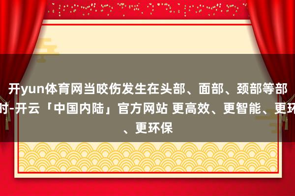 开yun体育网当咬伤发生在头部、面部、颈部等部位时-开云「中国内陆」官方网站 更高效、更智能、更环保